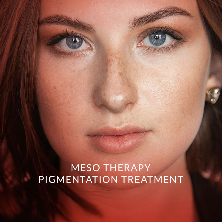 mesotherapy-pigmentation-treatment